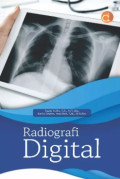 RADIOGRAFI DIGITAL